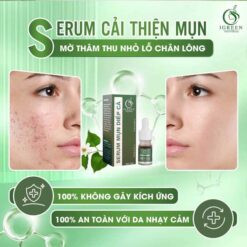 Serum Trị Mụn Diếp Cá Igreen